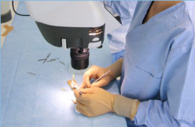 microscope greffe capillaire